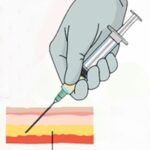 cinnatropin enjeksiyonu nasıl yapılır